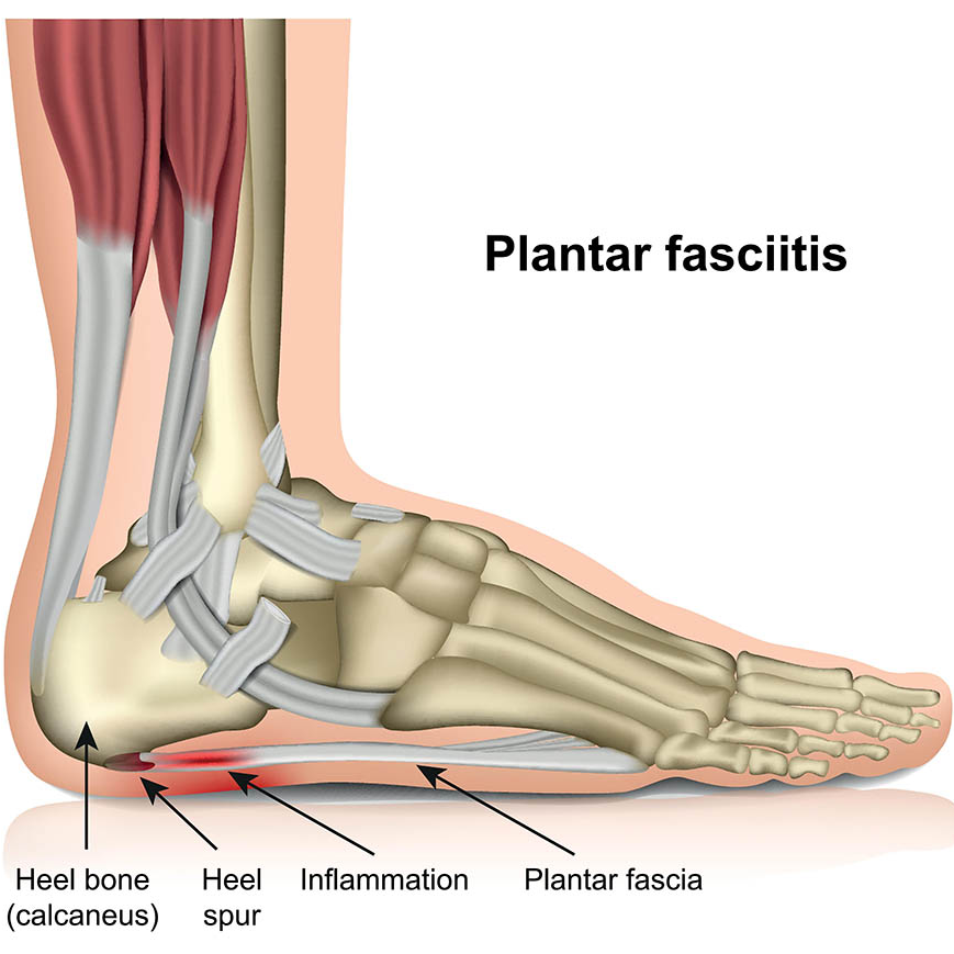 A diagram of the foot and ankle bones.